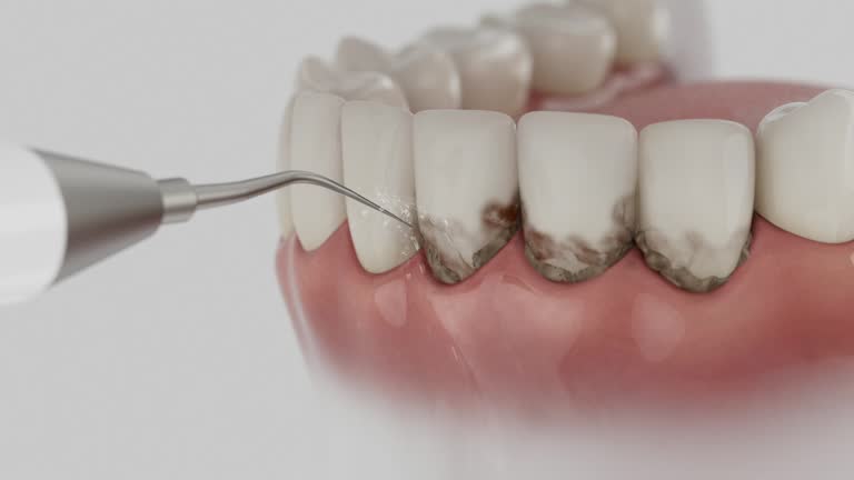 Reliable Teeth Cleaning And Checkup contractor in Stewart County County, GA by Dentist Open Now